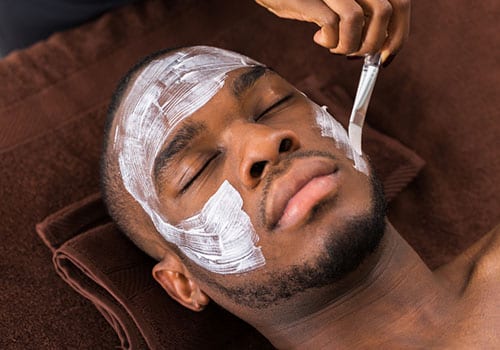 chemical peels